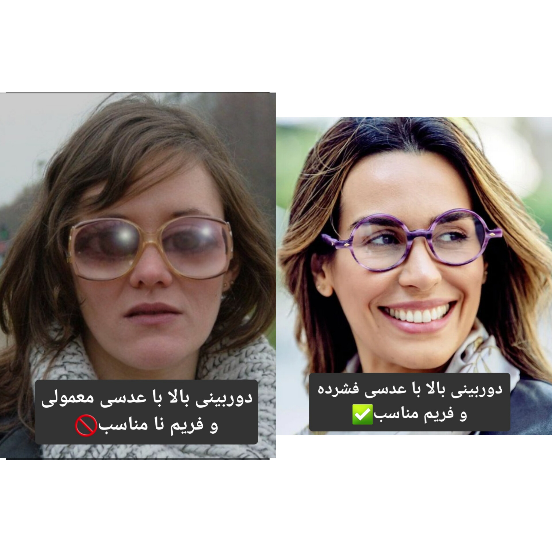 عیوب انکساری(Refractive errore)  -نزدیک بینی(myopia)